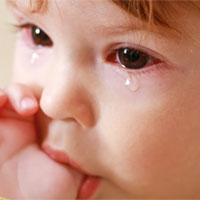 انسداد مجرای اشک کودک