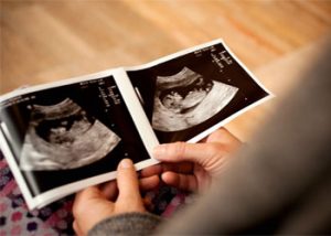 تشخیص جنسیت جنین در سونوگرافی