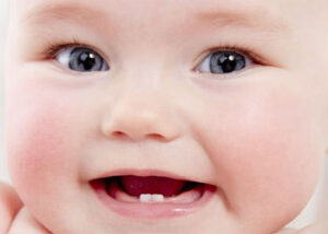 جلوگیری از پوسیدگی دندان کودک