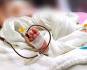 انتقال خون به نوزاد نارس